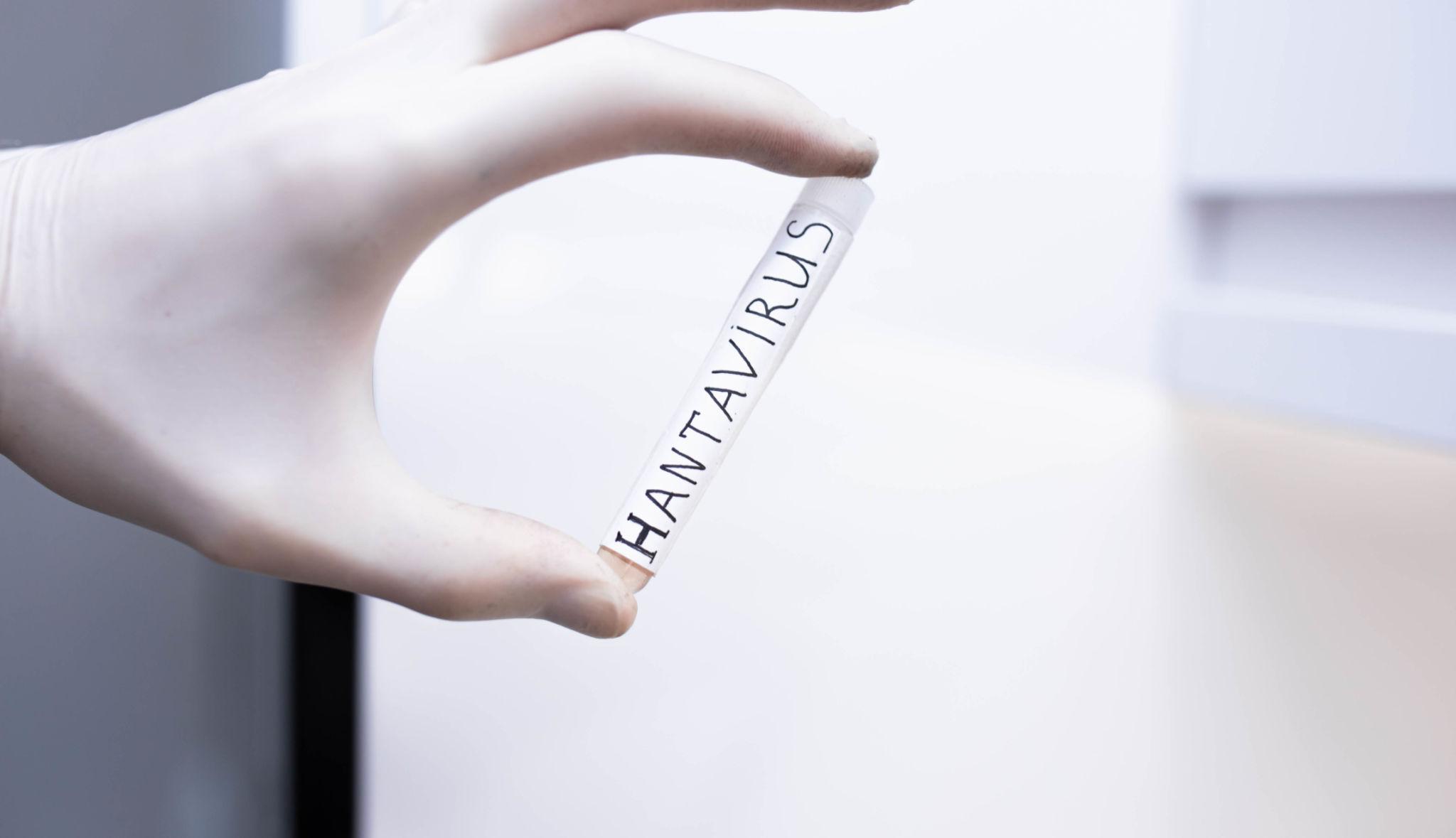 Hantavirus: advierten que una vacuna aún podría demorar varios años